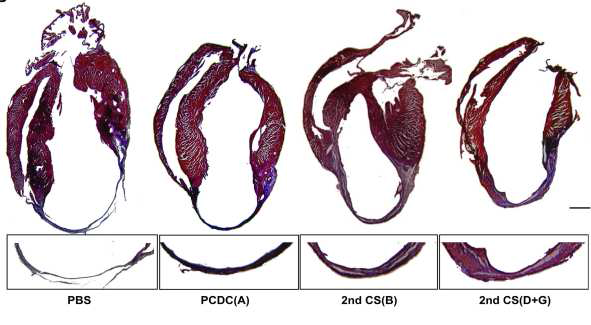 대조군 PBS 주입군과 대조 줄기세포 A보다 D+G 혼합 이식이 심근경색 치유에 월등히 효과적임 (Masson trichrome staining).