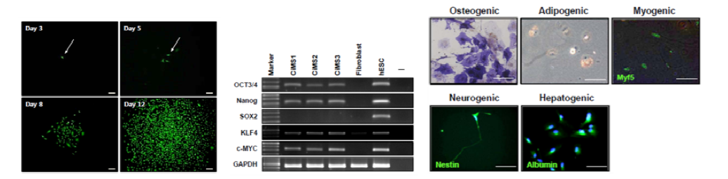 CiMS의 콜로니 형성 모습과 stemness 유전자의 발현 및 삼배엽으로의 분화