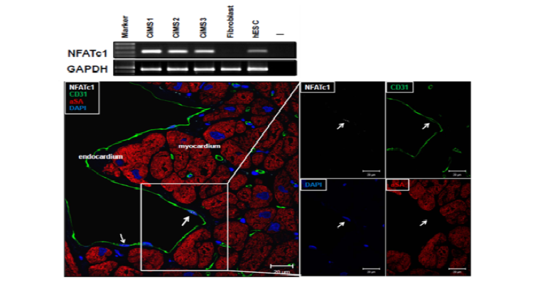 CiMS의 마커인 NFATc1의 발현과 심장에서의 CD31, NFATc1염색으로 심장내막에 존재하는 CiMS를 동정함