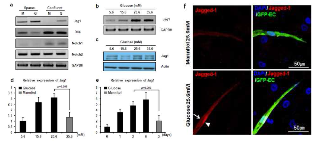 고농도의 포도당 조건에서 혈관내피세포의 Jagged-1 분자 발현의 증가를 확인