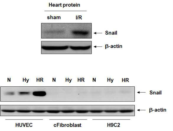 심근경색후 재관류한 심장에서 snail 단백질이 증폭되고, snail을 발현하는 세포는 혈관내피세포 (HUVEC)임를 확인함.