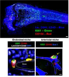 마우스 femoral bone을 염색하여 KAI1 양성 최상위 줄기세포 위치 탐색.