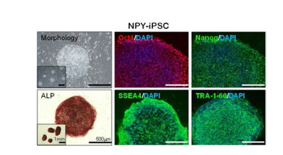 NPY 첨가 유무에 따른 역분화 유도 효율 변이를 세포모양 및 ALP 염색과 면역화학염색 실험을 통해 확인