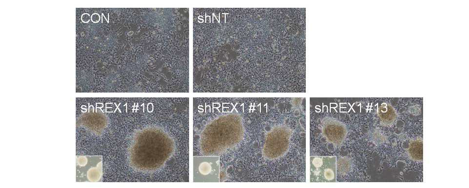 Rex1 발현 억제 세포주 확립