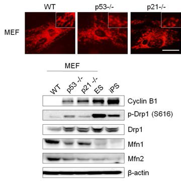 p53, p21 KO 세포에서 마이토콘드리아 fusion인자인 Mfn의 발현 감소 확인