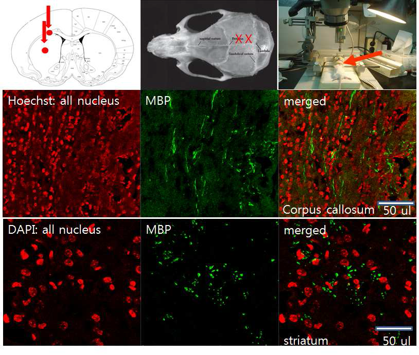 Myelin basic protein의 형광 면역조직화학염색.