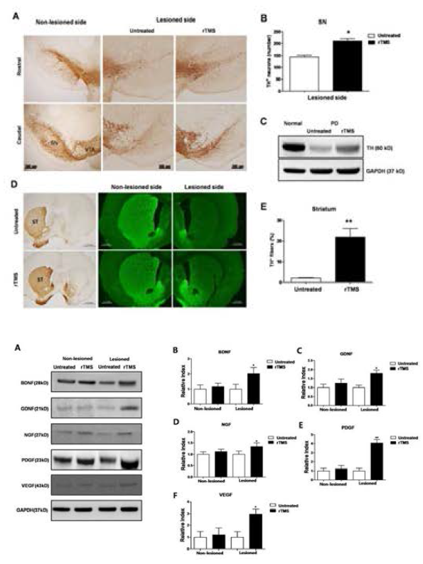 반복경두개자기자극(rTMS)에 의한 도파민 신경세포와 신경섬유의 생존율 변화 및 신경성장인자 발현의 변화.