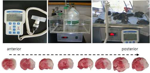 성인 저산소 허혈성 뇌손상 동물 모델