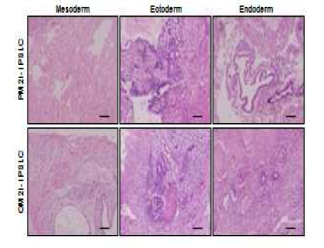 sIn vitvo에서 teratoma 형성을 통해 역분화 줄기세포가 외배엽, 중배엽, 내배엽으로 모두 분화 가능함을 확인
