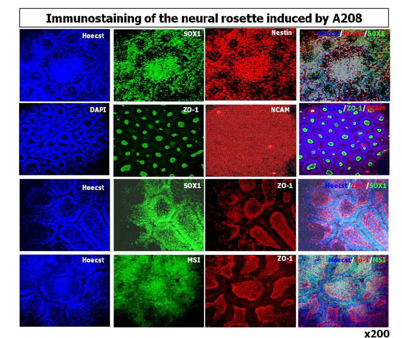 소분자화합물 (A209)에 의해 xeno-free 배지 상태에서 분화된 신경전구세포의 면역염 색 실험.
