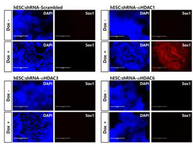 siRNA transfection 방법을 이용하여 동일한 실험을 한 결과 역시 HDAC1을 저해