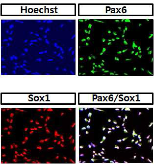 대표적인 NSC의 마커를 이용하여 ciNSC를 분석한 결과 Pax6, Sox1 과 같은 초기 neural markers들이 많이 발현이 됨.