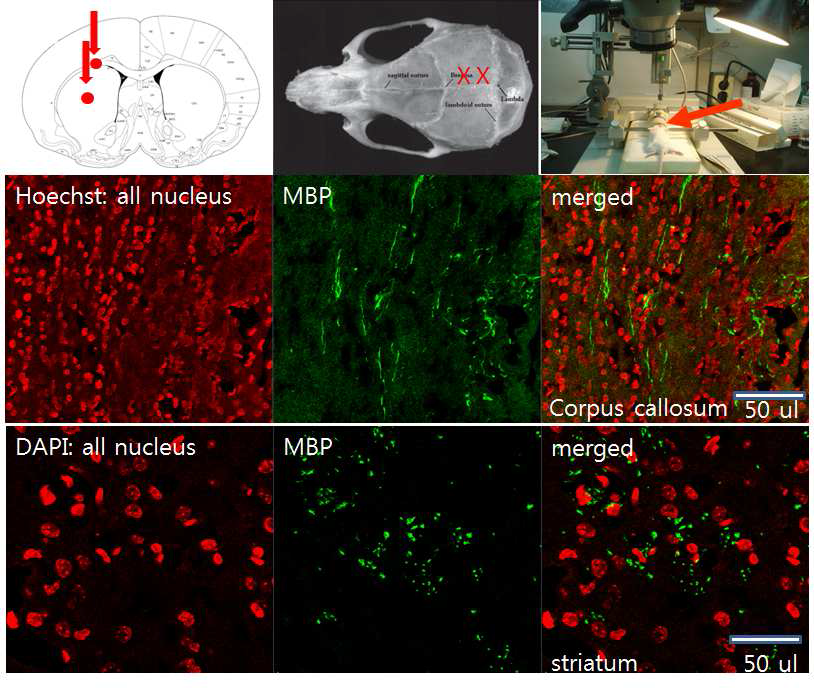 Myelin basic protein(MBP)의 형광 면역조직화학염색. Mutant Mouse에 인간유래 oligodendrocyte 전구체를 이식후 myelin이 분회된 MBP positive들을 확인 하였음.