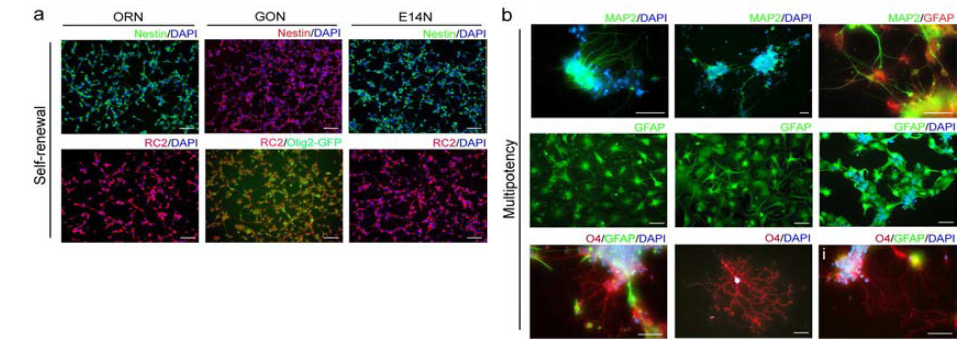 마우스 배아줄기세포에서 derivation 된 신경줄기세포의 마커단백질 발현 Nestin, RC2 와 multipotency를 neuron (MAP2), astrocyte (GFAP) 그리고 oligodendrocyte (O4)로의 분화로 확인함.