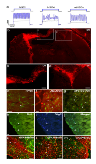 Photothrombotic Ischemia Model에서 유도된 신경줄기세포의 신경세포로의 분화 및 전기생리학적 작용 분석을 통하여 기능 확인.
