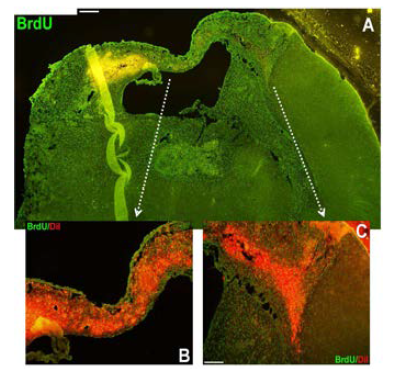 BrdU와 CM-DiI label된 공여세포의 생착과 뇌경색 부위로의 이주.