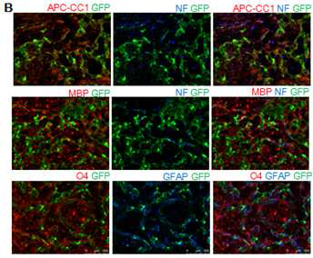 렛트 척수손상 동물모델에 이식한 GFP label된 유도신경줄기세포가 손상된 조직 내에서 APC-CC1, MBP, O4, GFAP 마커를 발 현하는 것 확인.