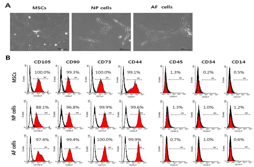 동일 환자로부터 분리된 골수 줄기세포와 NP세포 그리고 AF세포의 줄기세포학적 특성을 분석하였음. 다소 차이는 있으나 NP 및 AF세포 모두 mesenchymal stem cells의 특성을 나타냄을 확인함.