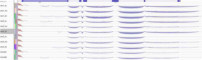 RNA-Seq을 통한 Splicing variation의 규명.