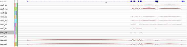 RNA-Seq을 통한 Splicing variation의 규명.