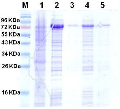정제된 MBP-D586-D841 PKC Mu 의 SDS-PAGE 분석 결과