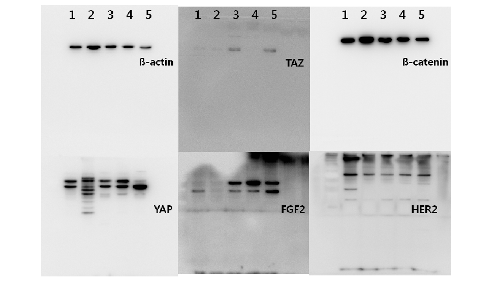 실제 위암 세포주를 사용한 웨스턴블랏(western blot)Cell line 1, MKN-28; 2, MKN-45; 3, SNU-484; 4, SNU-638; 5, YCC-9