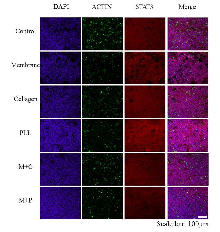 Immunofluorescence staining 결과.