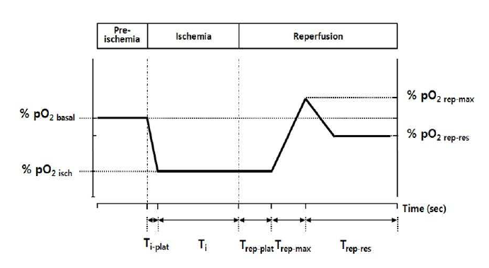 심근허혈-재관류시 pO2 변화량 분석을 위한 파라미터.