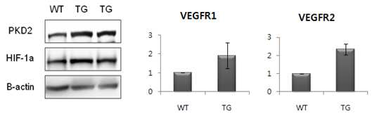 Pkd2 Tg 마우스의 신장 조직에서 HIF-1a (protein), VEGFR1, VEGFR2 (mRNA) 발현 패턴 검증
