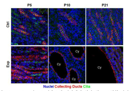 Ift46 조건 KO 마우스의 신장에서 일차 섬모 표현형 관찰