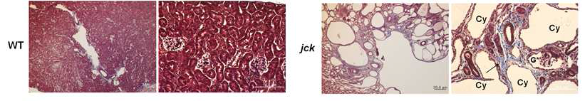 정상 신장 조직과 Jck 다낭신 모델의 신장 조직에서 섬유화 표현형 관찰