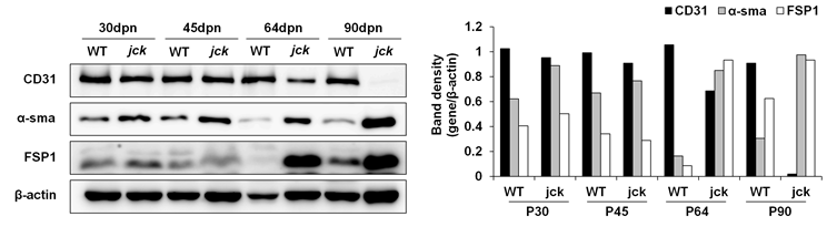 Jck 마우스의 신장에서 내피세포 마커와 mesenchymal cell 마커들의 발현 패턴 비교