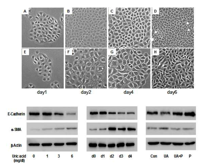 요산에 의한 NRK cell의 EMT : 세포 형태의 변화 (상) 및 western blotting (하).