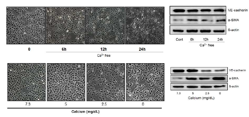 칼슘 농도 변화에 의한 혈관 내피세포의 endo-MT