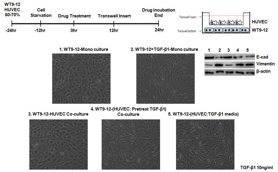 HUVEC과 WT9-12 Co-culture 실험에서 WT9-12의 EMT 발생