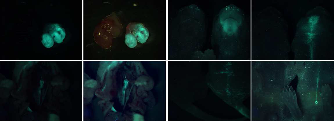 CAG-GFP/SM22-cre 마우스의 평활근 세포에서 초록 형광 발현을 확인한 대표 사진