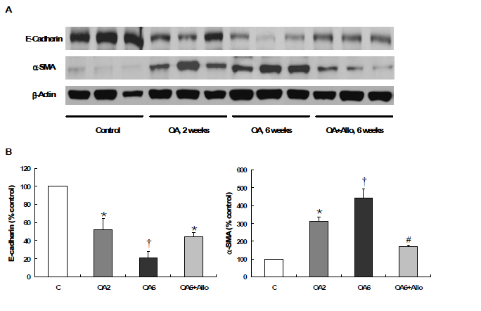 만성신장병에서 신장 상피세포의 표현형 변이 (EMT): Western blotting OA, oxonic acid; Allo, allopurinol