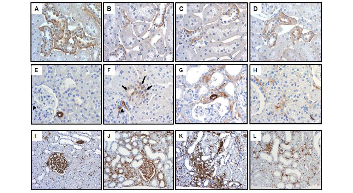 만성신장병에서 신장 상피세포의 표현형 변이 (EMT): 면역화학 염색 A, E, I, 정상; B, F, J, Oxonic acid (OA) 투여 (고요산혈증 동물) 2주; C, G, K, OA투여 8주; D, H, I, OA+allopurinol, 8주. E-cadherin (A-D); α-SMA (E-H), vimentin (I-L)