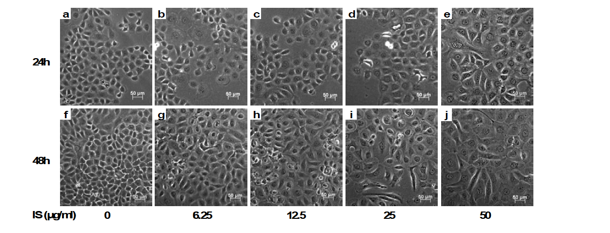 IS에 의한 신장상피세포의 EMT: IS 농도 및 시간에 따른 세포 형태의 변화