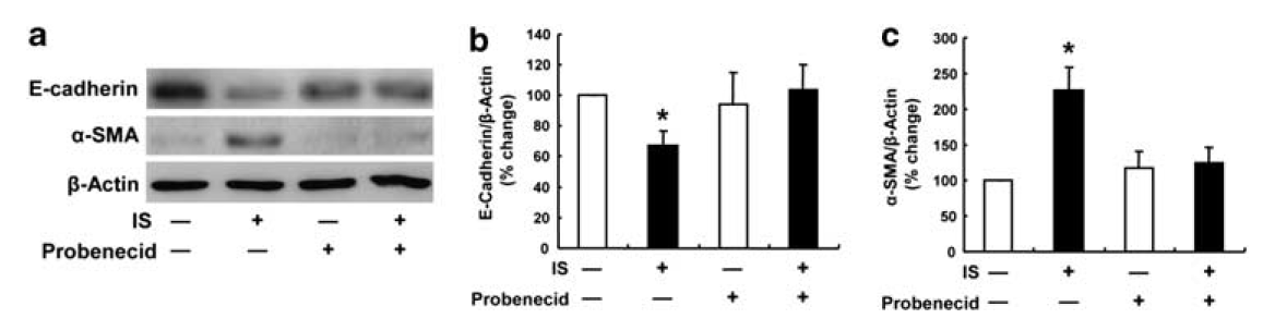 Probenecid가 IS에 의한 신장상피세포의 EMT에 미치는 영향