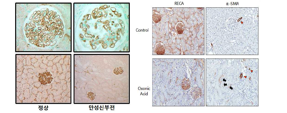 만성 신장병에서 신장의 Endo-MT: aging rat (좌측) 및 hyperuricemic rat (우측) Black arrow indicates Endo-MT of PTC and red arrow heads denote normal expression of α-SMA in arterioles