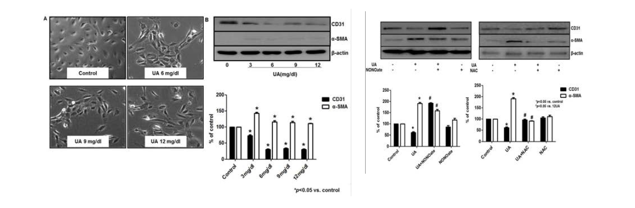 배양된 혈관 내피세포 (HUVEC, human umbilical vein endothelial cell)에서 요산 (UA)에 의한 endo-MT 및 NO donor (NONOate)/anti-oxidant (NAC)의 효과