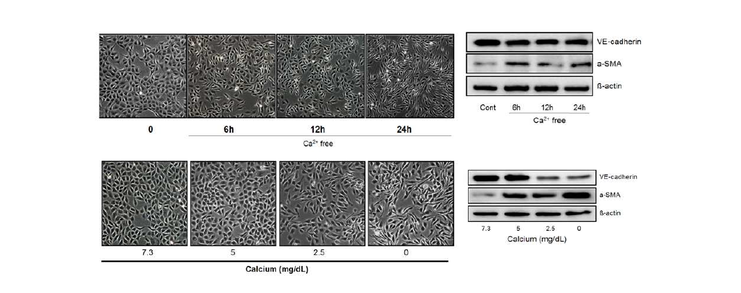 칼슘 농도 변화에 의한 혈관 내피세포의 endo-MT : Time- and dose-dependency