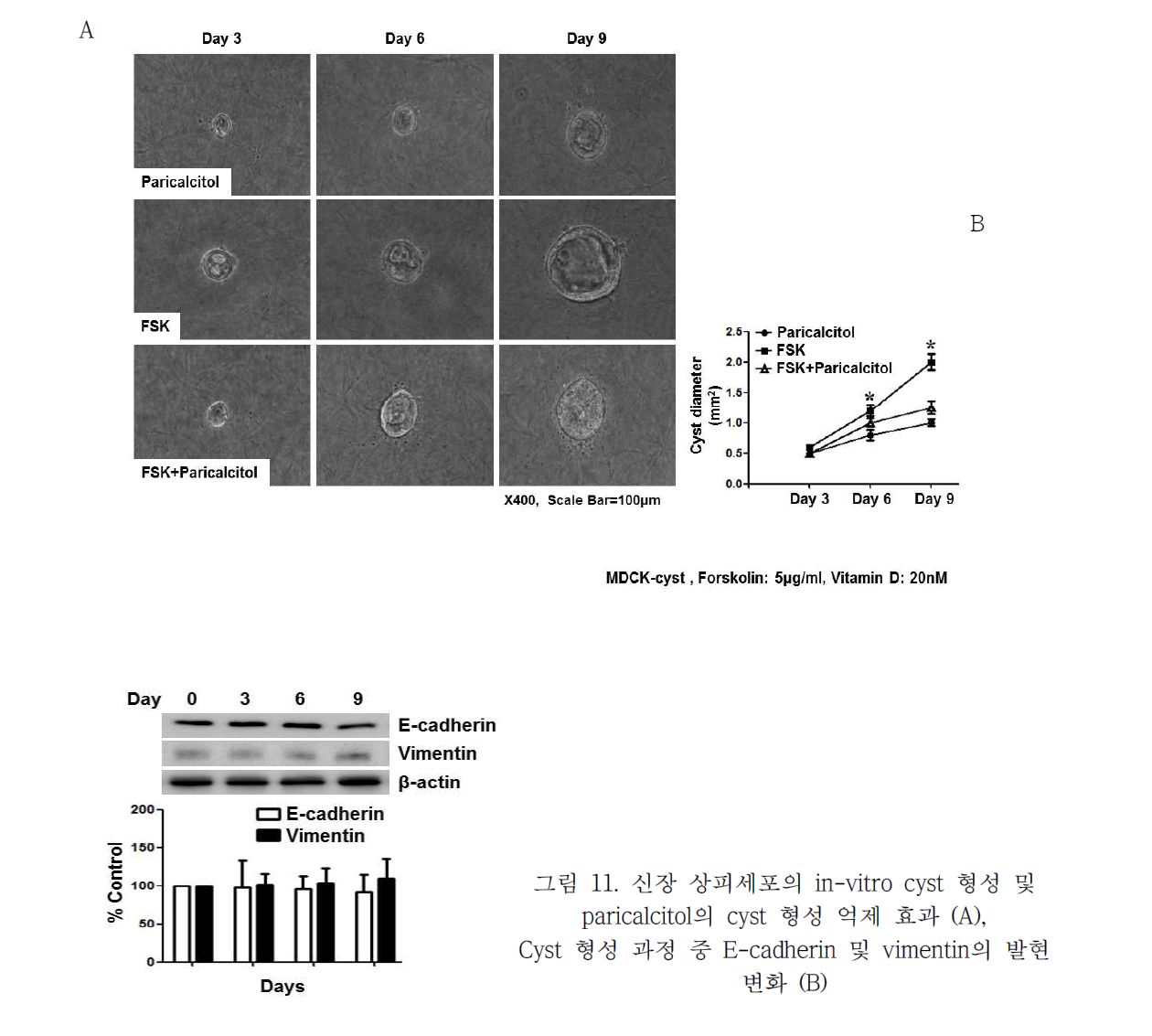 신장 상피세포의 in-vitro cyst 형성 및 paricalcitol의 cyst 형성 억제 효과 (A), Cyst 형성 과정 젓 E-cadherin 및 vimentin의 발현 변화 (B)