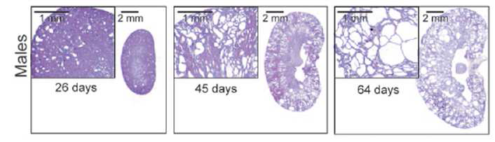Male Jck 마우스에서 시간에 따르는 신장 병리 소견 및 신장 낭종의 형성