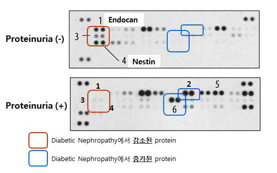 당뇨병 환자 신장조직에서 Proteome Profiling Analysis의 결과 example