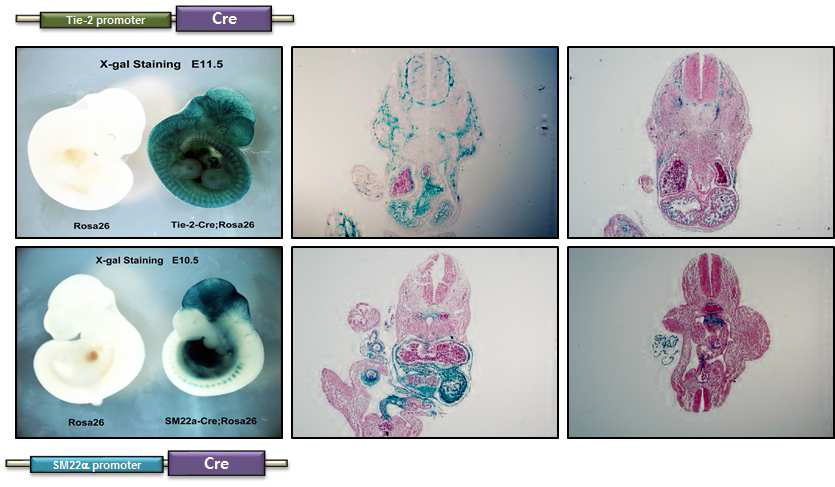 β-galactosidase staining을 통해 내피 세포 특이적(위), 평활근 세포 특이적(아래) 으로 Cre의 발현을 확인한 대표적 사진