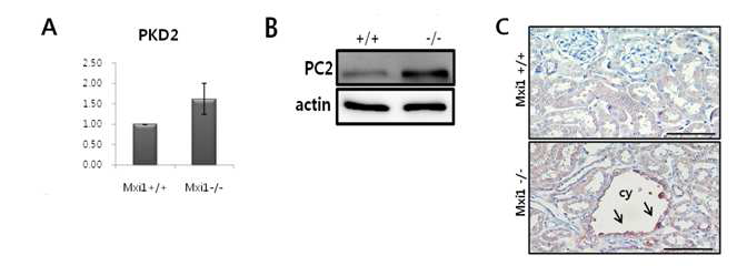 Mxi1 KO 마우스의 신장 조직에서 PC2 발현 레벨 검증