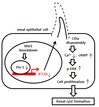 Mxi1 유전자의 inactivation을 통해 이루어지는 cilia disassembly 기작 및 낭포 형성 메커니즘에 대한 diagram