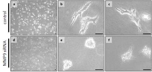 MMP9 유전자의 발현이 mIMCD-3의 tubulogenesis에 미치는 영향